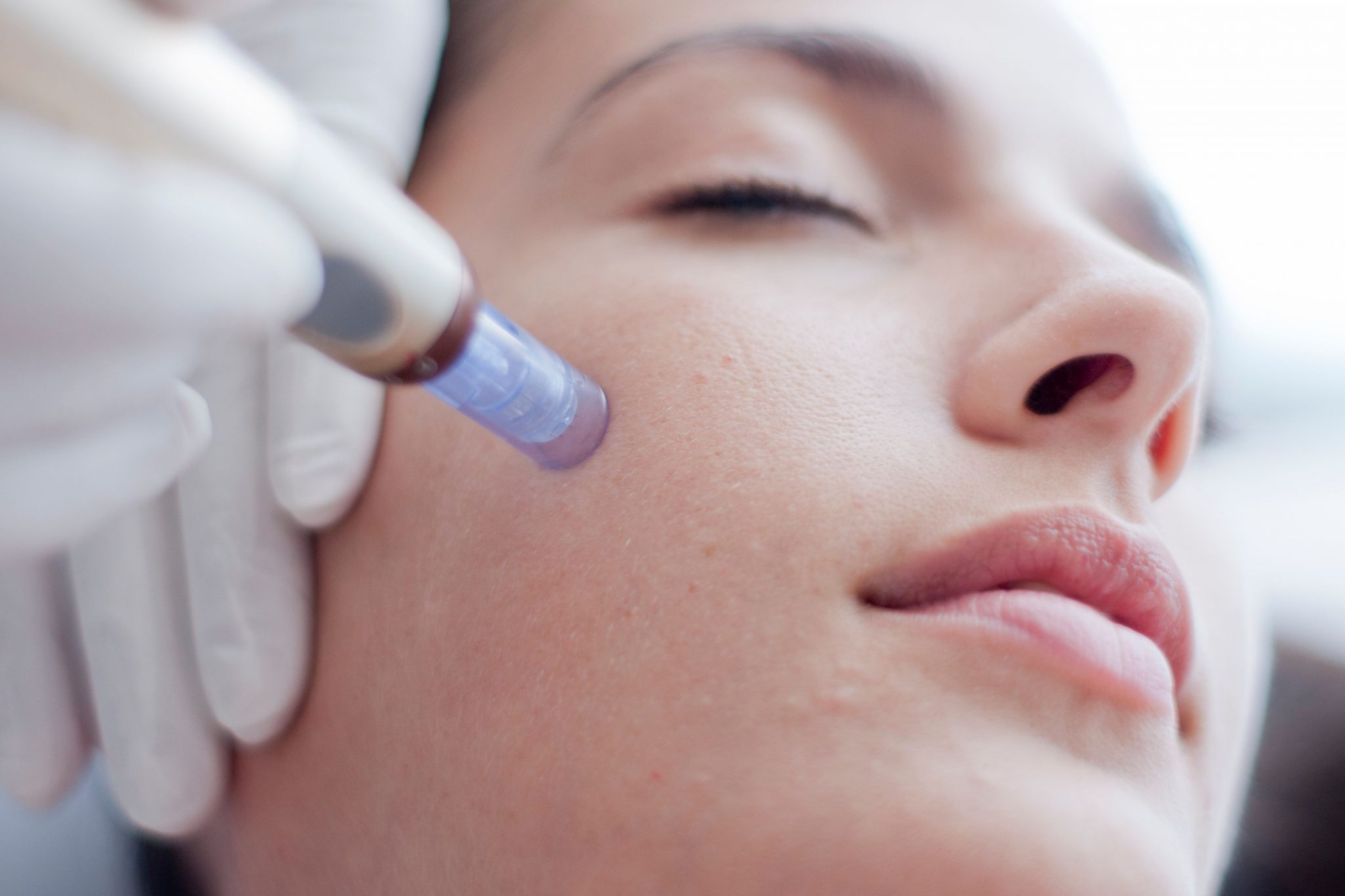 BBGlow Behandlung Dermanence Shop